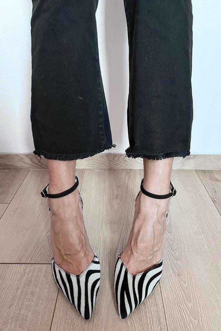 Lyra | Zebra Print Ankle Strap Pumps